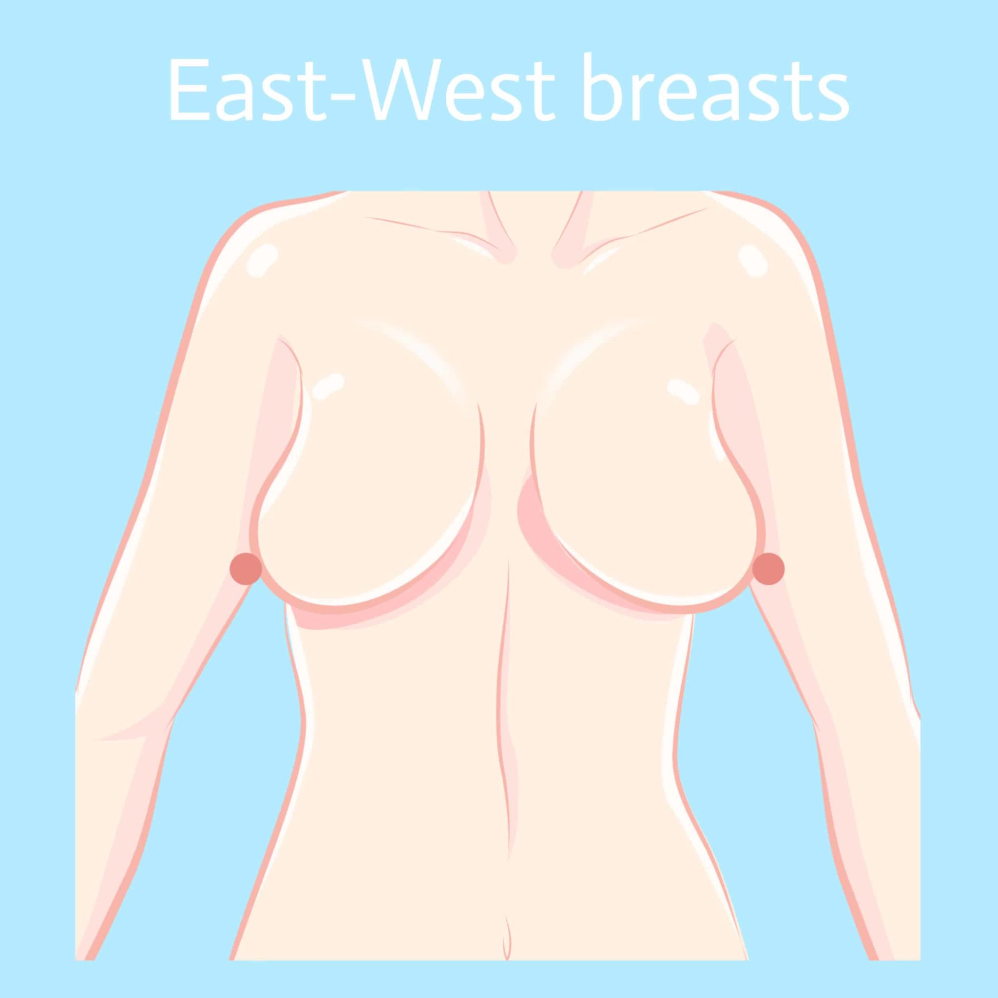 east west breasts