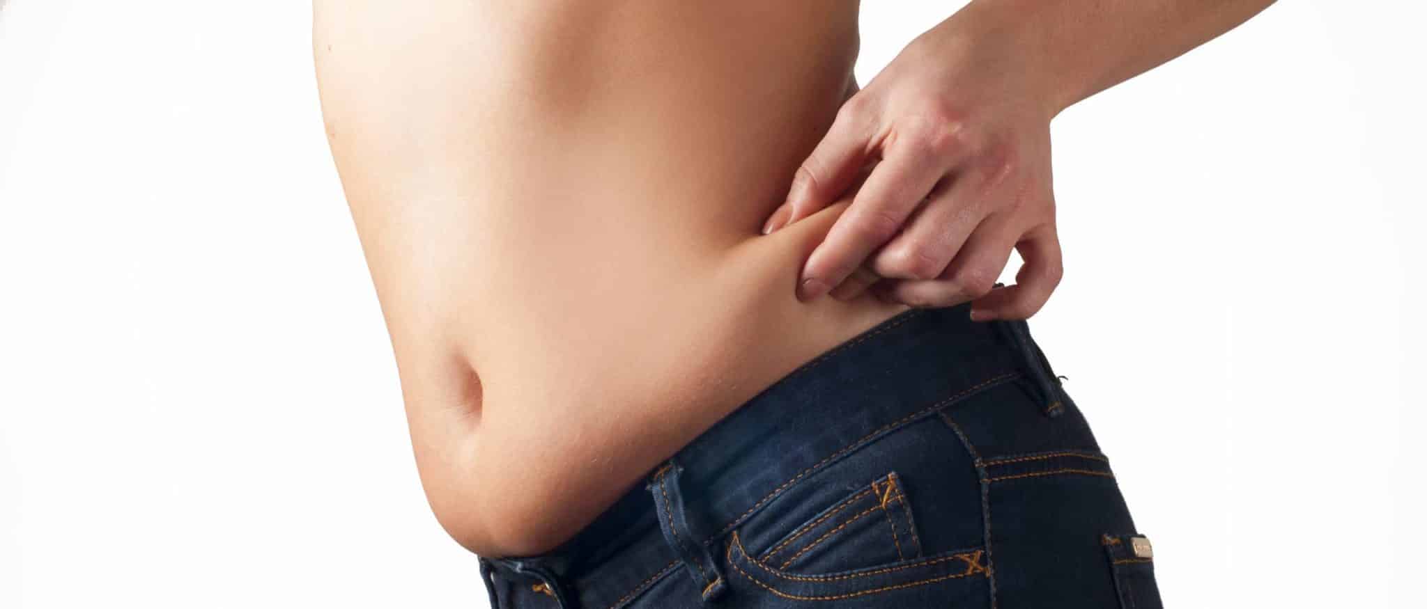 excess skin on abdomen, bmi for cosmetic surgery